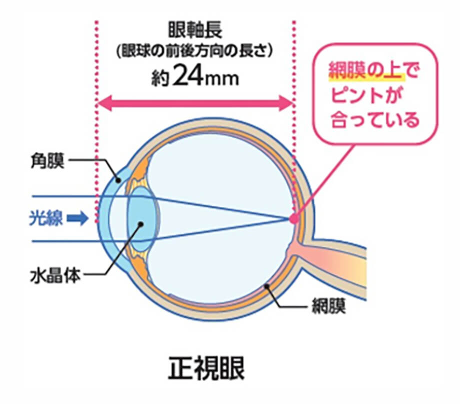正視眼