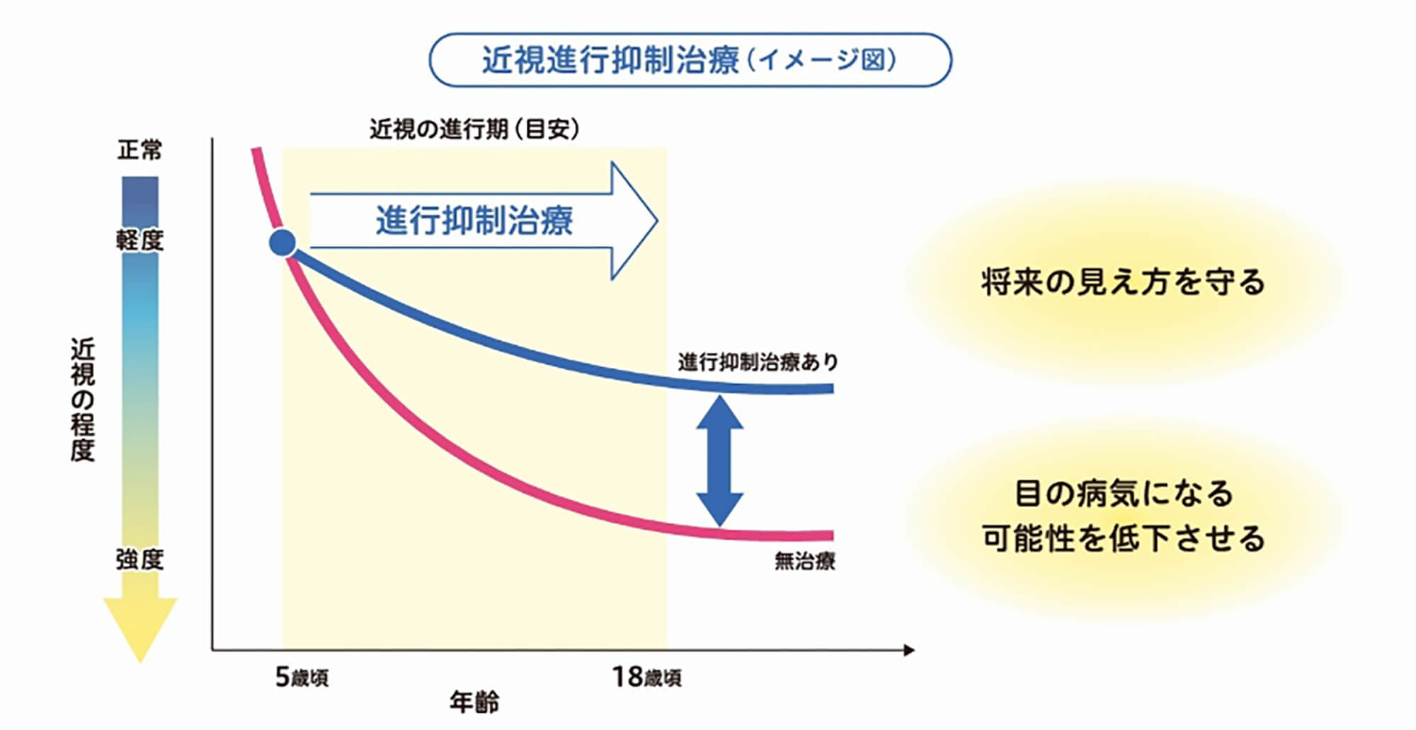 禁止信仰抑制治療（イメージ図）