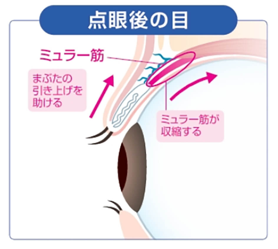 点眼後の目